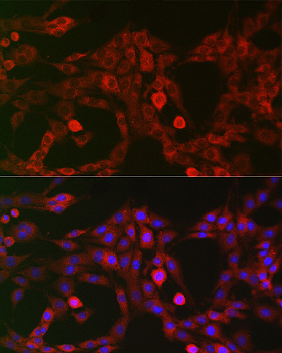 LRP5 Antibody in Immunocytochemistry (ICC/IF)