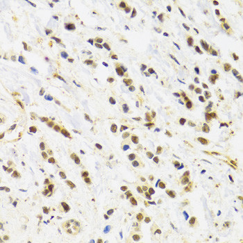 RAD50 Antibody in Immunohistochemistry (Paraffin) (IHC (P))