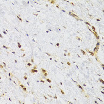 RAD50 Antibody in Immunohistochemistry (Paraffin) (IHC (P))