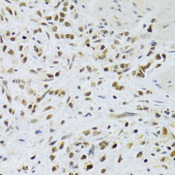 RAD50 Antibody in Immunohistochemistry (Paraffin) (IHC (P))