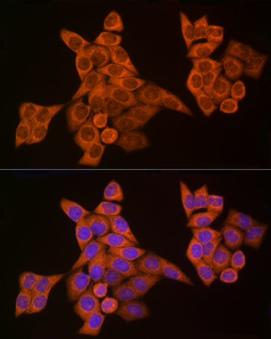 Caspase 8 Antibody in Immunocytochemistry (ICC/IF)