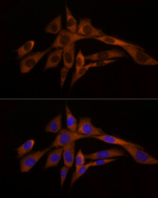 Caspase 8 Antibody in Immunocytochemistry (ICC/IF)