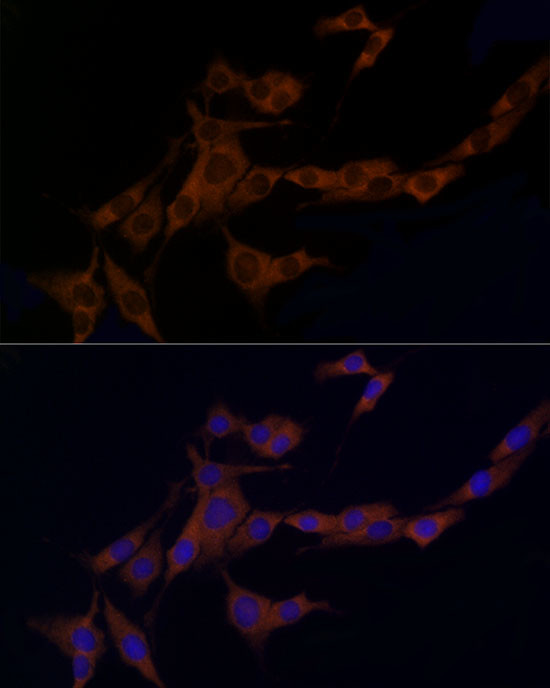 Caspase 8 Antibody in Immunocytochemistry (ICC/IF)