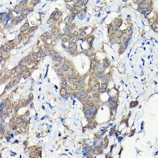 Caspase 8 Antibody in Immunohistochemistry (Paraffin) (IHC (P))