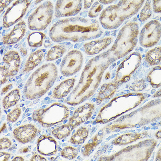 Caspase 8 Antibody in Immunohistochemistry (Paraffin) (IHC (P))