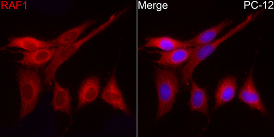 c-Raf Antibody in Immunocytochemistry (ICC/IF)