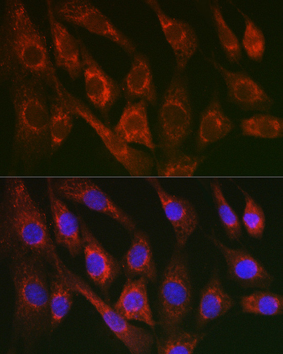 Cytochrome C Antibody in Immunocytochemistry (ICC/IF)