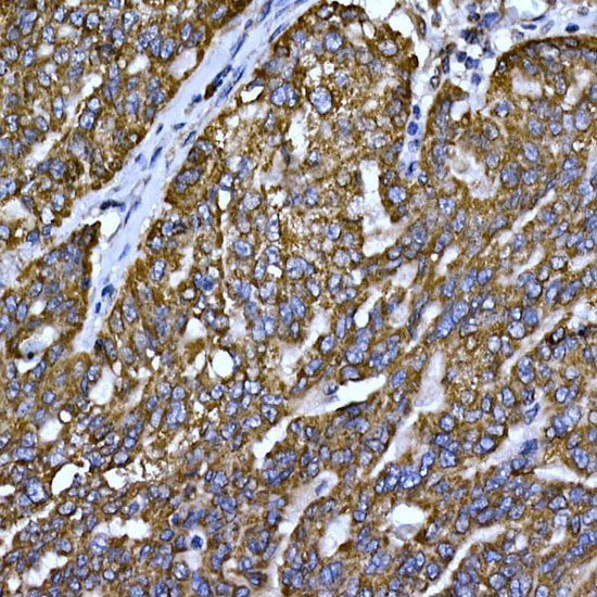 Cytochrome C Antibody in Immunohistochemistry (Paraffin) (IHC (P))