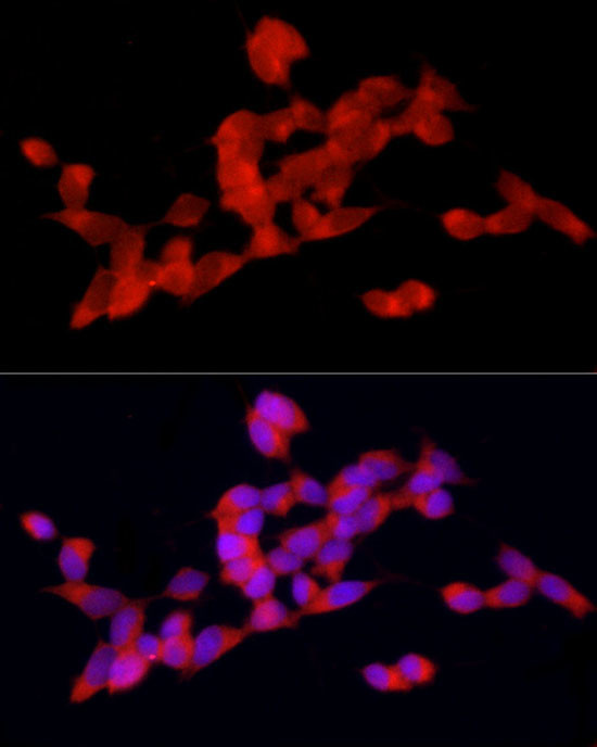 DOK4 Antibody in Immunocytochemistry (ICC/IF)