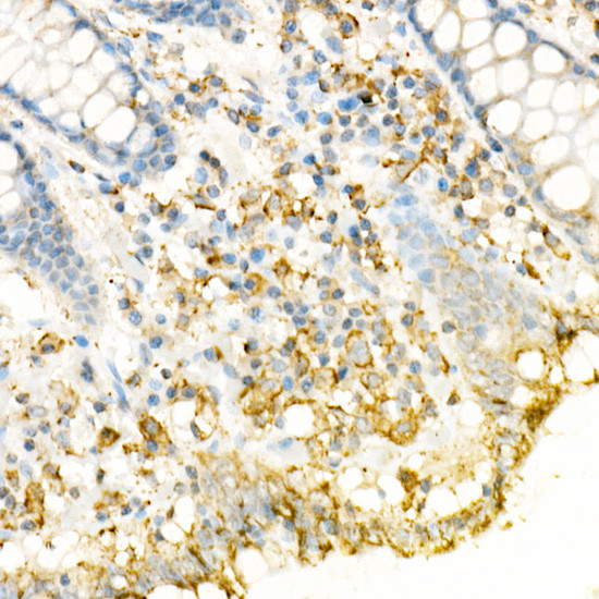 CD178 Antibody in Immunohistochemistry (Paraffin) (IHC (P))