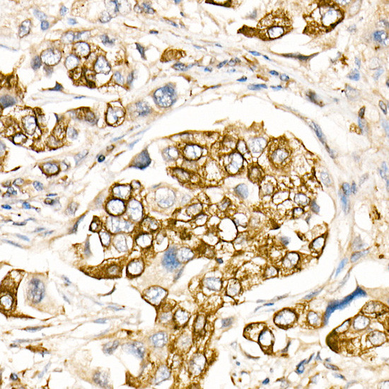 CD178 Antibody in Immunohistochemistry (Paraffin) (IHC (P))