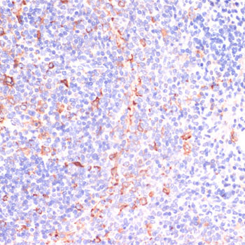 IKK epsilon Antibody in Immunohistochemistry (Paraffin) (IHC (P))