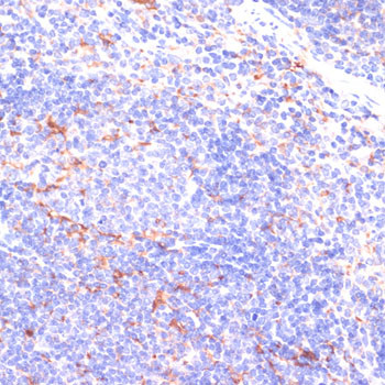 IKK epsilon Antibody in Immunohistochemistry (Paraffin) (IHC (P))