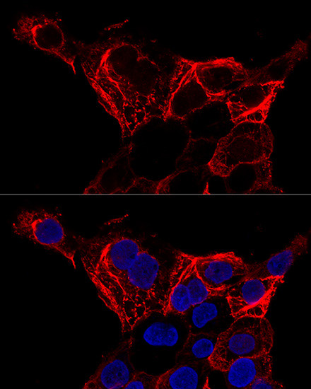 Cytokeratin 20 Antibody in Immunocytochemistry (ICC/IF)