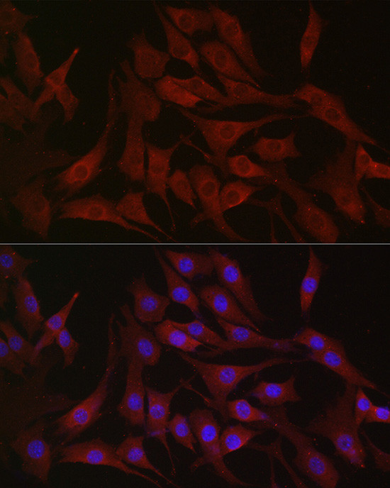 PIK3CA Antibody in Immunocytochemistry (ICC/IF)