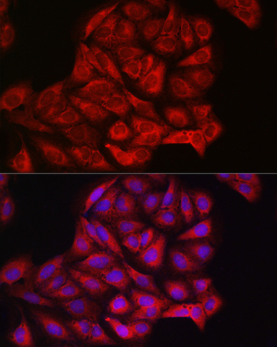 PIK3CA Antibody in Immunocytochemistry (ICC/IF)