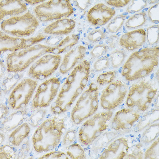 PIK3CA Antibody in Immunohistochemistry (Paraffin) (IHC (P))