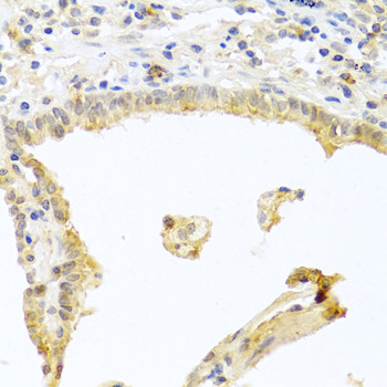 PKC alpha Antibody in Immunohistochemistry (Paraffin) (IHC (P))