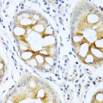 PKC alpha Antibody in Immunohistochemistry (Paraffin) (IHC (P))