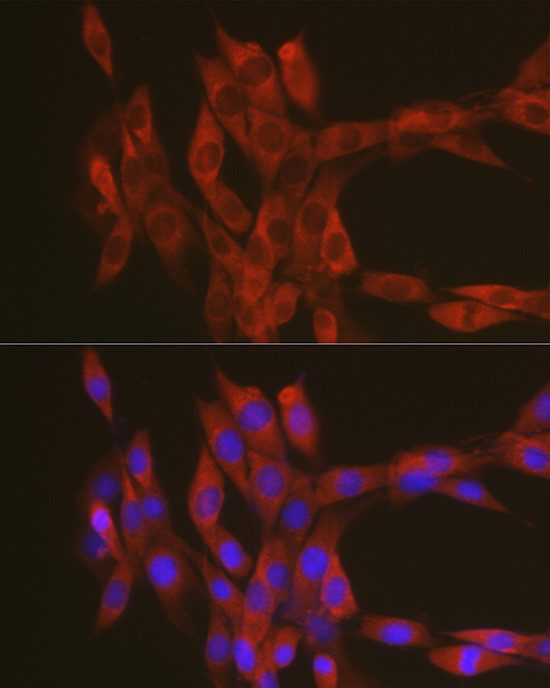 RhoA Antibody in Immunocytochemistry (ICC/IF)