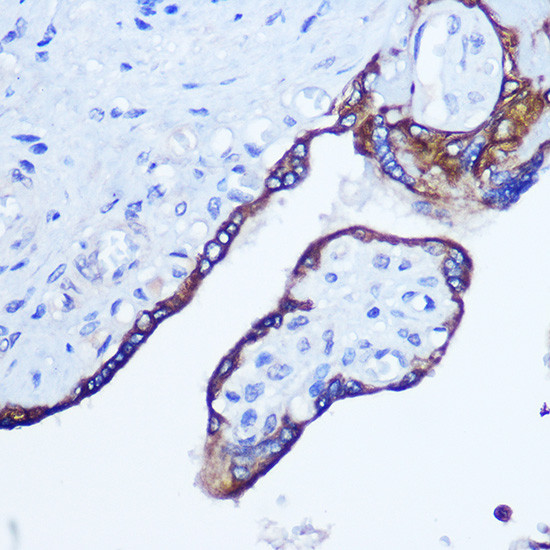 RhoA Antibody in Immunohistochemistry (Paraffin) (IHC (P))