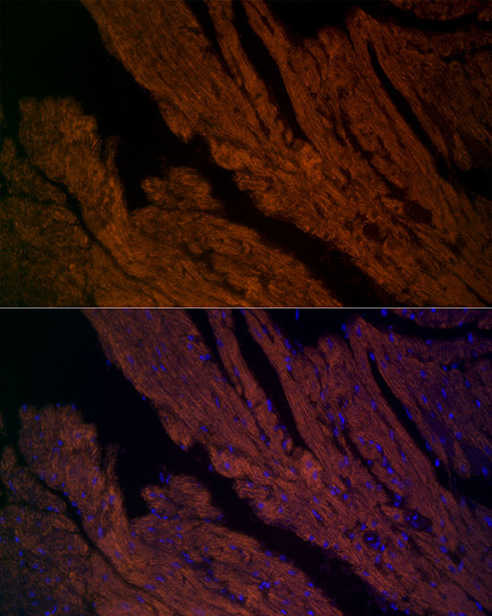 RyR2 Antibody in Immunocytochemistry (ICC/IF)