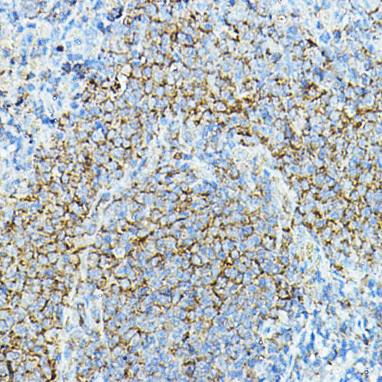 CD79a Antibody in Immunohistochemistry (Paraffin) (IHC (P))