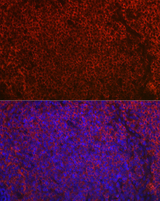 CD79a Antibody in Immunohistochemistry (Paraffin) (IHC (P))