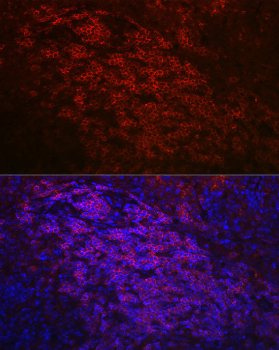 CD79a Antibody in Immunohistochemistry (Paraffin) (IHC (P))