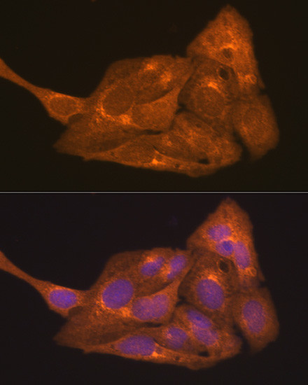 RARA Antibody in Immunocytochemistry (ICC/IF)