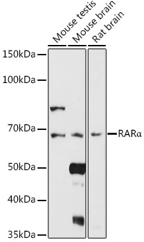 RARA Antibody in Western Blot (WB)