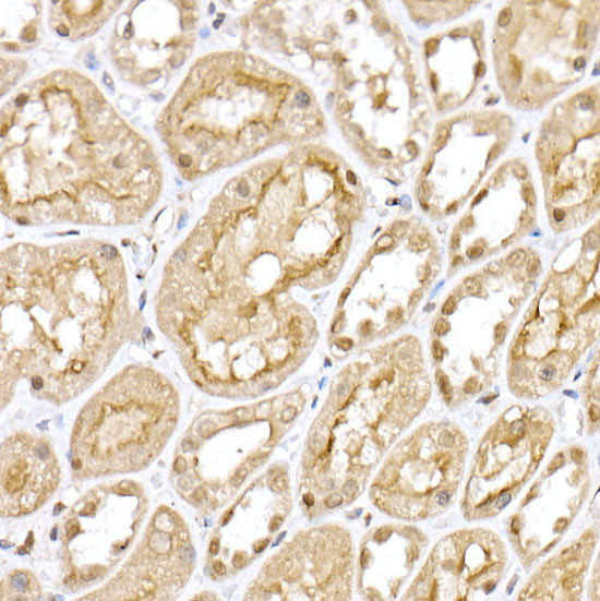 VHL Antibody in Immunohistochemistry (Paraffin) (IHC (P))