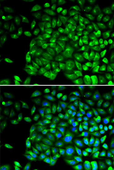 TNFR2 Antibody in Immunocytochemistry (ICC/IF)