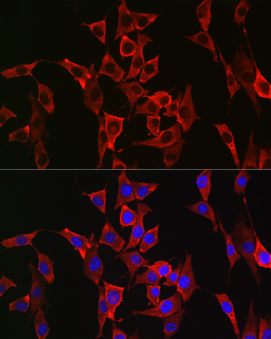 FGFR3 Antibody in Immunocytochemistry (ICC/IF)