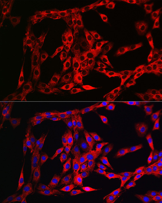 FGFR3 Antibody in Immunocytochemistry (ICC/IF)