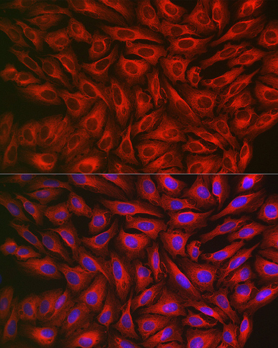 FGFR3 Antibody in Immunocytochemistry (ICC/IF)