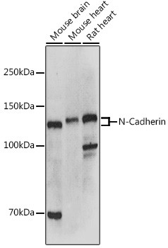 N-cadherin Antibody in Western Blot (WB)