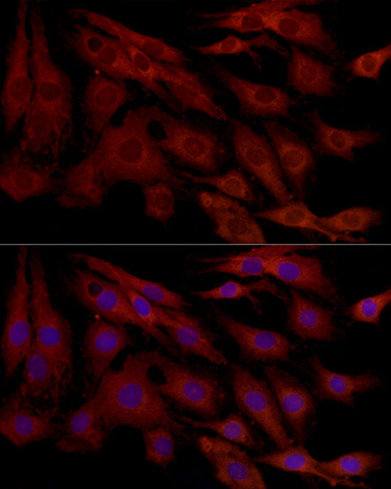 MCL-1 Antibody in Immunocytochemistry (ICC/IF)