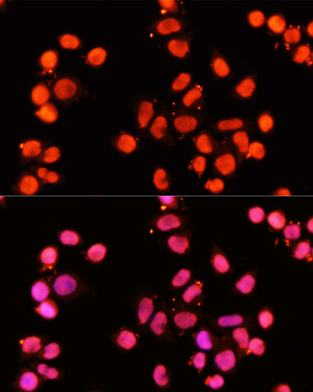 XRCC1 Antibody in Immunocytochemistry (ICC/IF)