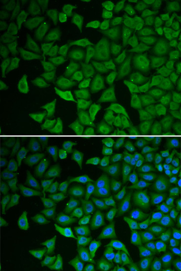 CHK2 Antibody in Immunocytochemistry (ICC/IF)