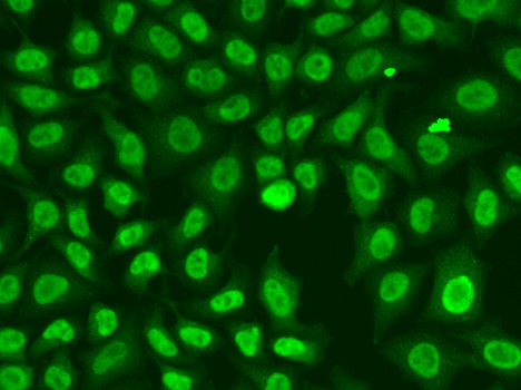 CHK2 Antibody in Immunocytochemistry (ICC/IF)