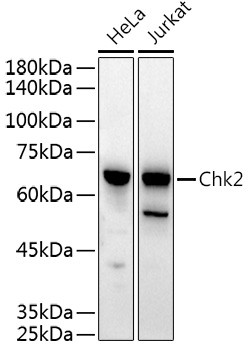 CHK2 Antibody in Western Blot (WB)