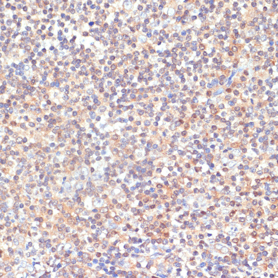 PKC delta Antibody in Immunohistochemistry (Paraffin) (IHC (P))