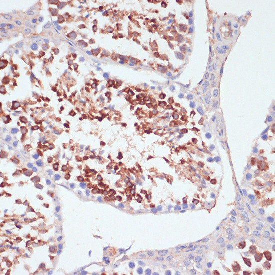 PKC delta Antibody in Immunohistochemistry (Paraffin) (IHC (P))