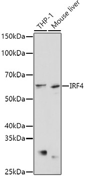 IRF4 Antibody in Western Blot (WB)