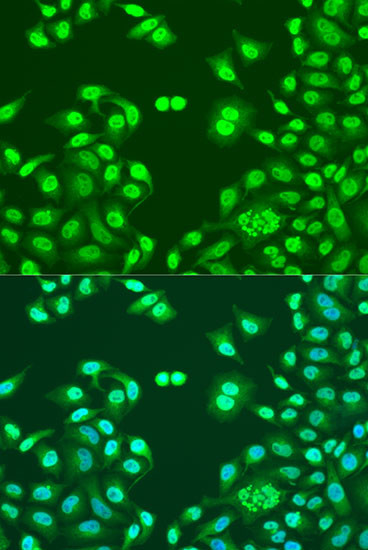 NuMA Antibody in Immunocytochemistry (ICC/IF)