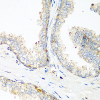 NEDD4 Antibody in Immunohistochemistry (Paraffin) (IHC (P))