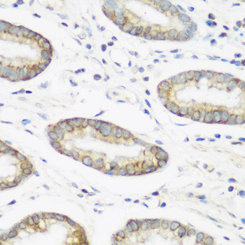 NEDD4 Antibody in Immunohistochemistry (Paraffin) (IHC (P))