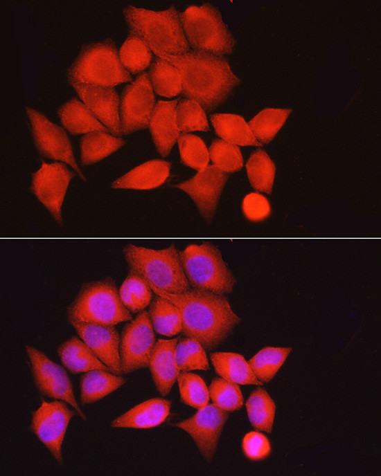 MYPT1 Antibody in Immunocytochemistry (ICC/IF)