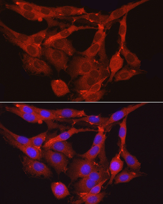 MYPT1 Antibody in Immunocytochemistry (ICC/IF)